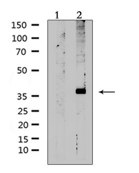 AVPR2 / V2R Antibody - Western blot analysis of extracts of rat muscle using AVPR2 antibody. Lane 1 was treated with the antigen-specific peptide.