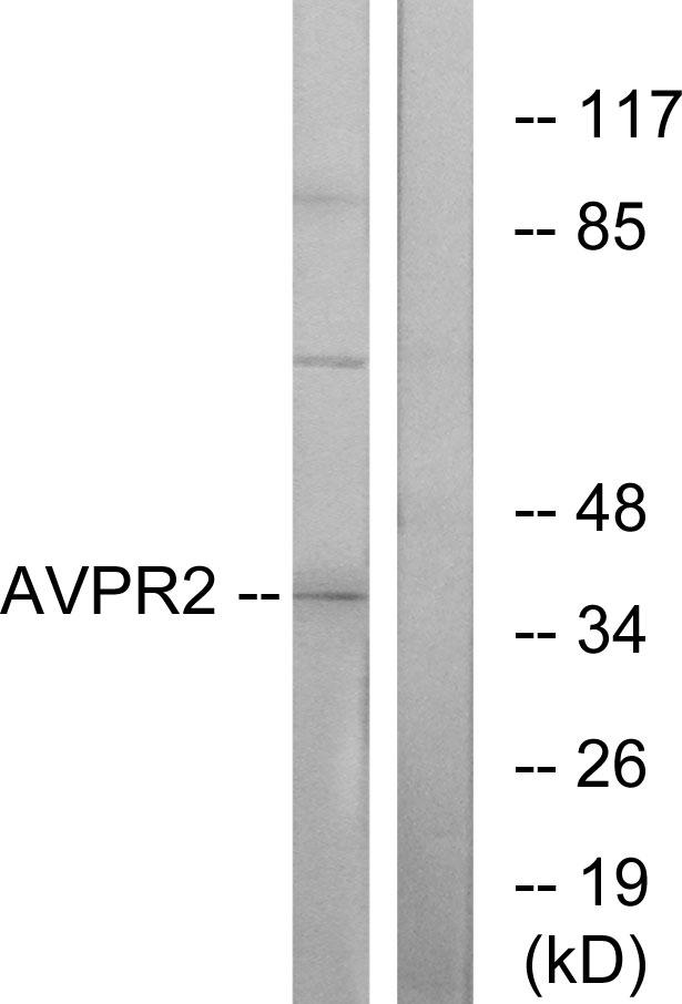 AVPR2 / V2R Antibody - Western blot analysis of extracts from RAW264.7 cells, using AVPR2 antibody.