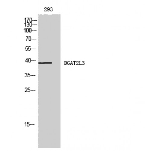 AWAT1 / DGAT2L3 Antibody - Western blot of DGAT2L3 antibody