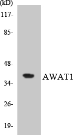 AWAT1 / DGAT2L3 Antibody - Western blot analysis of the lysates from HT-29 cells using AWAT1 antibody.
