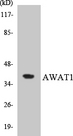 AWAT1 / DGAT2L3 Antibody - Western blot analysis of the lysates from HT-29 cells using AWAT1 antibody.