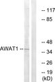 AWAT1 / DGAT2L3 Antibody - Western blot analysis of lysates from 293 cells, using AWAT1 Antibody. The lane on the right is blocked with the synthesized peptide.