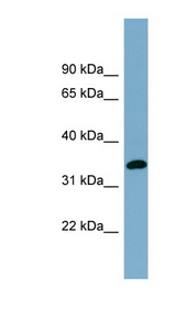 AWAT1 / DGAT2L3 Antibody - AWAT1 antibody Western blot of Fetal Stomach lysate. This image was taken for the unconjugated form of this product. Other forms have not been tested.
