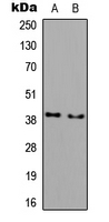 AWAT1 / DGAT2L3 Antibody - Western blot analysis of DGAT2L3 expression in COLO205 (A); NIH3T3 (B) whole cell lysates.