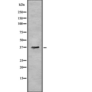 AWAT1 / DGAT2L3 Antibody - Western blot analysis of AWAT1 using NIH-3T3 whole cells lysates