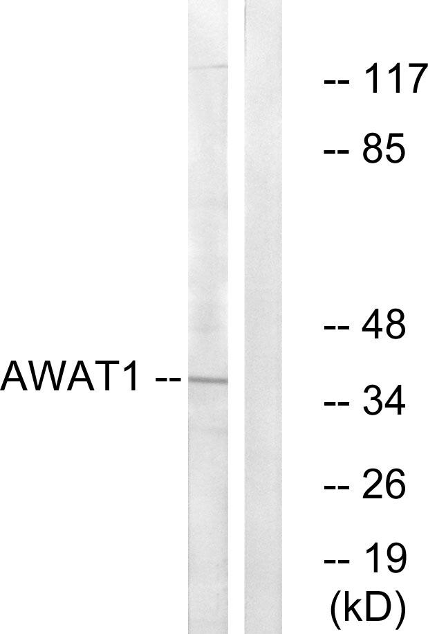AWAT1 / DGAT2L3 Antibody - Western blot analysis of extracts from 293 cells, using AWAT1 antibody.