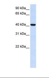 AWAT2 / DGAT2L4 Antibody - Fetal brain lysate. Antibody concentration: 1.0 ug/ml. Gel concentration: 12%.  This image was taken for the unconjugated form of this product. Other forms have not been tested.