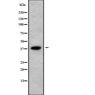 AWAT2 / DGAT2L4 Antibody - Western blot analysis of AWAT2 using HepG2 whole cells lysates