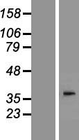 AWAT2 / DGAT2L4 Protein - Western validation with an anti-DDK antibody * L: Control HEK293 lysate R: Over-expression lysate