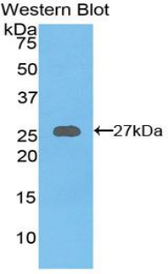 AXIN1 / Axin-1 Antibody - Western blot of recombinant AXIN1 / Axin-1.  This image was taken for the unconjugated form of this product. Other forms have not been tested.