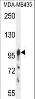 AXIN1 / Axin-1 Antibody - AXIN1 Antibody western blot of MDA-MB435 cell line lysates (35 ug/lane). The AXIN1 antibody detected the AXIN1 protein (arrow).