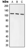 AXIN1 / Axin-1 Antibody - Western blot analysis of Axin-1 expression in HEK293T (A); NIH3T3 (B); PC12 (C) whole cell lysates.