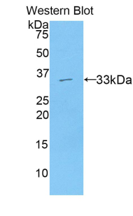 AXIN2 / Axin 2 Antibody - Western blot of recombinant AXIN2 / Axin 2.  This image was taken for the unconjugated form of this product. Other forms have not been tested.