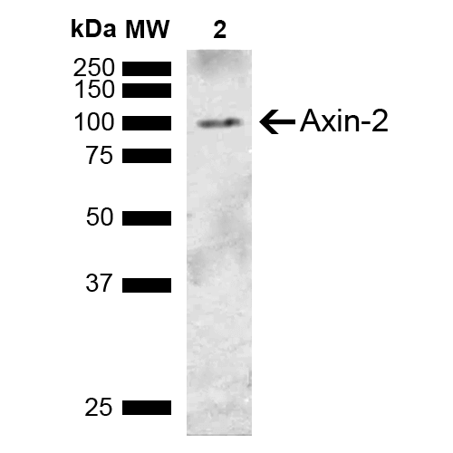 AXIN2 / Axin 2 Antibody - Western blot analysis of Rat Lung showing detection of ~93.5 kDa Axin-2 protein using Rabbit Anti-Axin-2 Polyclonal Antibody. Lane 1: Molecular Weight Ladder (MW). Lane 2: Rat Lung. Load: 15 µg. Block: 5% Skim Milk in 1X TBST. Primary Antibody: Rabbit Anti-Axin-2 Polyclonal Antibody  at 1:1000 for 2 hours at RT. Secondary Antibody: Goat Anti-Rabbit IgG: HRP at 1:3000 for 1 hour at RT. Color Development: ECL solution for 5 min at RT. Predicted/Observed Size: ~93.5 kDa.