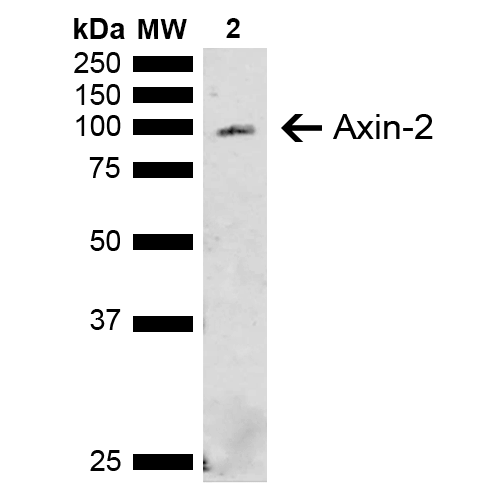AXIN2 / Axin 2 Antibody - Western blot analysis of Rat Liver showing detection of ~93.5 kDa Axin-2 protein using Rabbit Anti-Axin-2 Polyclonal Antibody. Lane 1: Molecular Weight Ladder (MW). Lane 2: Rat Liver. Load: 15 µg. Block: 5% Skim Milk in 1X TBST. Primary Antibody: Rabbit Anti-Axin-2 Polyclonal Antibody  at 1:1000 for 2 hours at RT. Secondary Antibody: Goat Anti-Rabbit IgG: HRP at 1:3000 for 1 hour at RT. Color Development: ECL solution for 5 min at RT. Predicted/Observed Size: ~93.5 kDa.