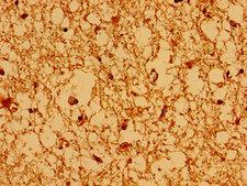 AXIN2 / Axin 2 Antibody - Immunohistochemistry image of paraffin-embedded human brain tissue at a dilution of 1:100