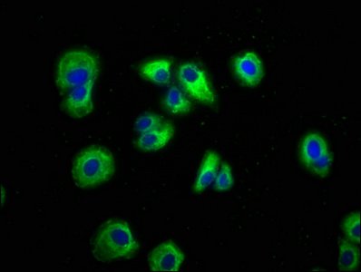 AXIN2 / Axin 2 Antibody - Immunofluorescence staining of HepG2 cells with AXIN2 Antibody at 1:166, counter-stained with DAPI. The cells were fixed in 4% formaldehyde, permeabilized using 0.2% Triton X-100 and blocked in 10% normal Goat Serum. The cells were then incubated with the antibody overnight at 4°C. The secondary antibody was Alexa Fluor 488-congugated AffiniPure Goat Anti-Rabbit IgG(H+L).