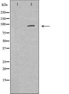 AXIN2 / Axin 2 Antibody - Western blot analysis of SW480 cell lysates using AXIN2 antibody. The lane on the left is treated with the antigen-specific peptide.