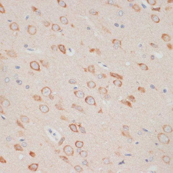 AXIN2 / Axin 2 Antibody - Immunohistochemistry of paraffin-embedded Rat brain using AXIN2 Polyclonal Antibody at dilution of 1:100 (40x lens).