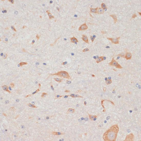 AXIN2 / Axin 2 Antibody - Immunohistochemistry of paraffin-embedded Mouse spinal cord using AXIN2 Polyclonal Antibody at dilution of 1:100 (40x lens).