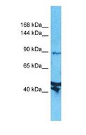 AXIN2 / Axin 2 Antibody - Western blot of AXIN2 Antibody with human Jurkat Whole Cell lysate.  This image was taken for the unconjugated form of this product. Other forms have not been tested.