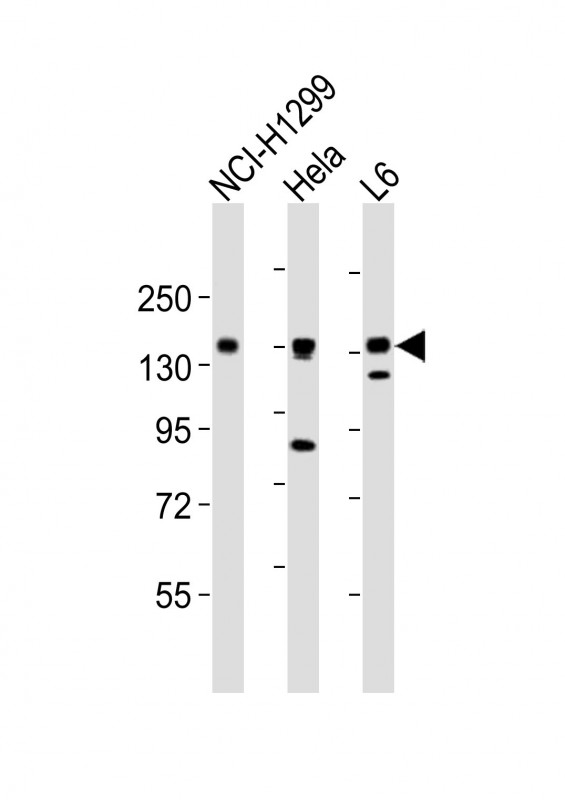 AXL Antibody - All lanes : Anti-AXL Antibody at 1:2000 dilution Lane 1: NCI-H1299 whole cell lysates Lane 2: HeLa whole cell lysates Lane 3: L6 whole cell lysates Lysates/proteins at 20 ug per lane. Secondary Goat Anti-Rabbit IgG, (H+L), Peroxidase conjugated at 1/10000 dilution Predicted band size : 98 kDa Blocking/Dilution buffer: 5% NFDM/TBST.