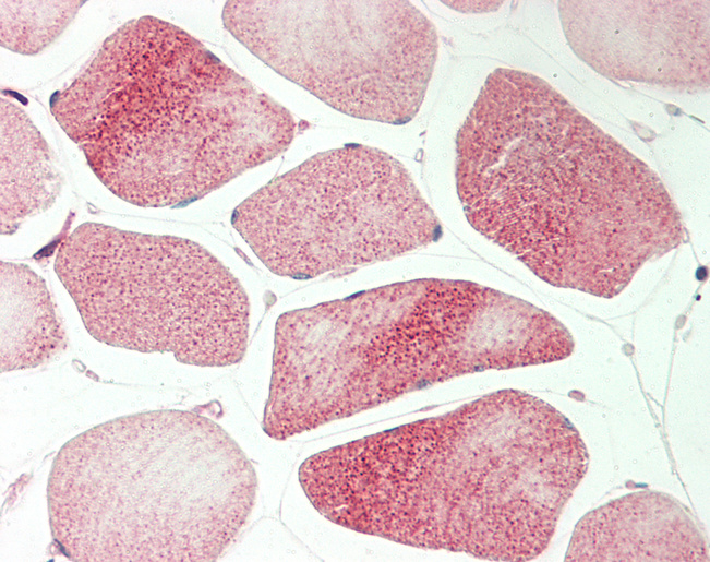 AXL Antibody - Human Skeletal Muscle: Formalin-Fixed, Paraffin-Embedded (FFPE).  This image was taken for the unconjugated form of this product. Other forms have not been tested.