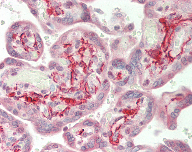 AXL Antibody - Human Placenta: Formalin-Fixed, Paraffin-Embedded (FFPE).  This image was taken for the unconjugated form of this product. Other forms have not been tested.