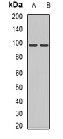 AXL Antibody - Western blot analysis of AXL expression in HUVEC (A); HEK293T (B) whole cell lysates.