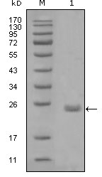 AXL Antibody - Western blot using AXL mouse monoclonal antibody against truncated Trx-AXL recombinant protein (1).