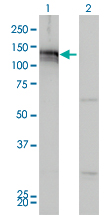 AXL Antibody - Western Blot analysis of AXL expression in transfected 293T cell line by AXL monoclonal antibody (M01), clone 6C8.Lane 1: AXL transfected lysate(98 KDa).Lane 2: Non-transfected lysate.