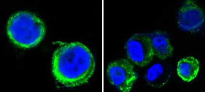 AXL Antibody - Axl Antibody in Immunofluorescence (IF)