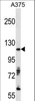 AXL Antibody - Western blot of anti-AXL Antibody in A375 cell line lysates (35 ug/lane). AXL(arrow) was detected using the purified antibody.