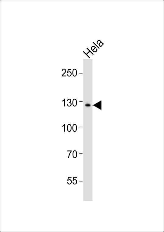 AXL Antibody - Western blot of lysate from HeLa cell line, using Rabbit Anti-AXL antibody (bs-5180R). bs-5180R was diluted at 1:1000. A goat anti-rabbit IgG H&L (HRP) at 1:10000 dilution was used as the secondary antibody.Lysate at 20 ug.