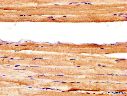 AXL Antibody - Immunohistochemistry image at a dilution of 1:400 and staining in paraffin-embedded human skeletal muscle tissue performed on a Leica BondTM system. After dewaxing and hydration, antigen retrieval was mediated by high pressure in a citrate buffer (pH 6.0) . Section was blocked with 10% normal goat serum 30min at RT. Then primary antibody (1% BSA) was incubated at 4 °C overnight. The primary is detected by a biotinylated secondary antibody and visualized using an HRP conjugated SP system.