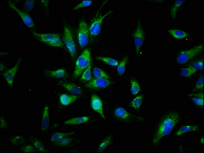 AXL Antibody - Immunofluorescence staining of Hela cells with AXL Antibody at 1:144, counter-stained with DAPI. The cells were fixed in 4% formaldehyde, permeabilized using 0.2% Triton X-100 and blocked in 10% normal Goat Serum. The cells were then incubated with the antibody overnight at 4°C. The secondary antibody was Alexa Fluor 488-congugated AffiniPure Goat Anti-Rabbit IgG(H+L).