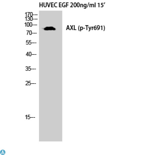 AXL Antibody - Immunohistochemical analysis of paraffin-embedded Human brain. Antibody was diluted at 1:100 (4°C, overnight). High-pressure and temperature Tris-EDTA, pH8.0 was used for antibody retrieval. Negative control (right) obtained from antibody was pre-absorbed by immunogen peptide.