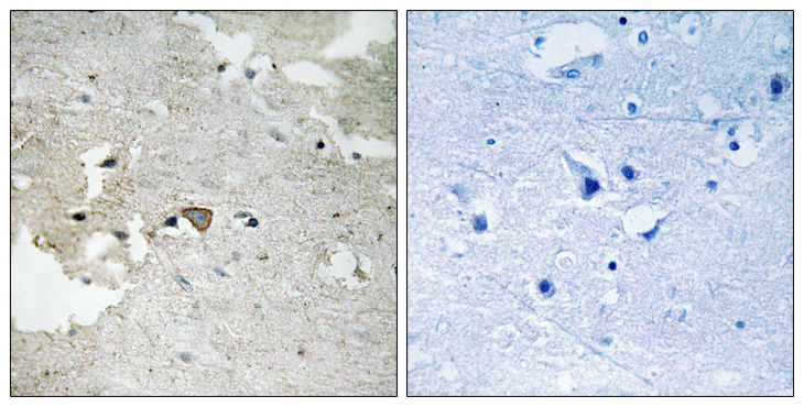 AXL Antibody - Immunohistochemistry analysis of paraffin-embedded human brain, using AXL (Phospho-Tyr691) Antibody. The picture on the right is blocked with the phospho peptide.