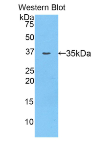 AZGP1 / ZAG Antibody - Western blot of recombinant AZGP1 / ZAG.  This image was taken for the unconjugated form of this product. Other forms have not been tested.