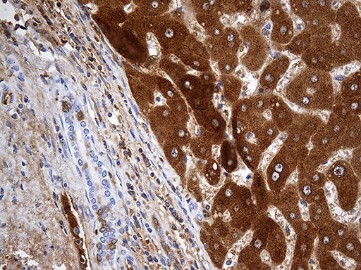 AZGP1 / ZAG Antibody - Immunohistochemical staining of paraffin-embedded Human liver tissue within the normal limits using anti-AZGP1 mouse monoclonal antibody. (Heat-induced epitope retrieval by 1mM EDTA in 10mM Tris buffer. (pH8.5) at 120°C for 3 min. (1:2000)