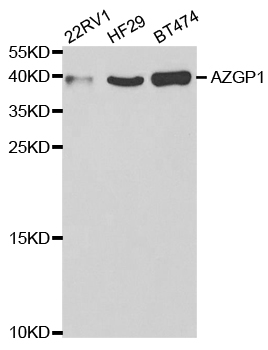 AZGP1 / ZAG Antibody - Western blot analysis of extracts of various cell lines.