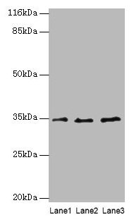 AZGP1 / ZAG Antibody - Western blot All lanes: AZGP1 antibody at 4µg/ml Lane 1: PC-3 whole cell lysate Lane 2: MCF-7 whole cell lysate Lane 3: LO2 whole cell lysate Lane 4: 293T whole cell lysate Lane 5: Hela whole cell lysate Lane 6: HepG2 whole cell lysate Lane 7: K562 whole cell lysate Secondary Goat polyclonal to rabbit IgG at 1/10000 dilution Predicted band size: 34 kDa Observed band size: 34 kDa