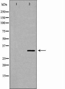 AZGP1 / ZAG Antibody - Western blot analysis of HeLa whole cells lysates using AZGP1 antibody. The lane on the left is treated with the antigen-specific peptide.