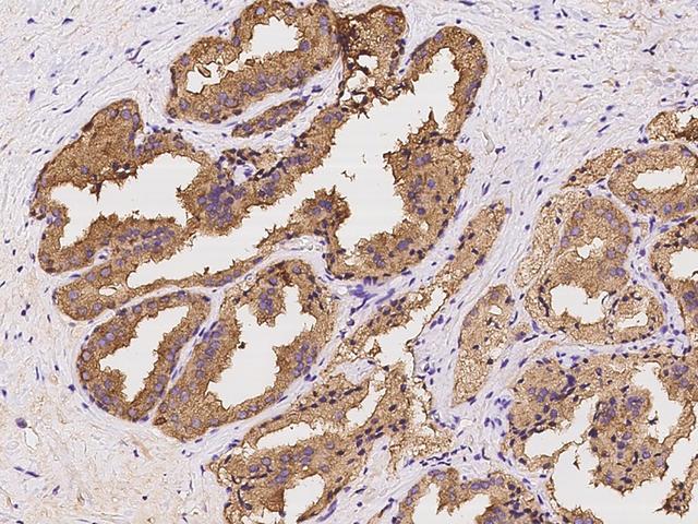 AZGP1 / ZAG Antibody - Immunochemical staining of human AZGP1 in human prostate with rabbit polyclonal antibody at 1:2000 dilution, formalin-fixed paraffin embedded sections.