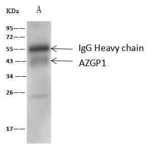 AZGP1 / ZAG Antibody - AZGP1 was immunoprecipitated using: Lane A: 0.5 mg Colo-205 Whole Cell Lysate. 2 uL anti-AZGP1 rabbit polyclonal antibody and 60 ug of Immunomagnetic beads Protein A/G. Primary antibody: Anti-AZGP1 rabbit polyclonal antibody, at 1:100 dilution. Secondary antibody: Goat Anti-Rabbit IgG (H+L)/HRP at 1/10000 dilution. Developed using the ECL technique. Performed under reducing conditions. Predicted band size: 34 kDa. Observed band size: 43 kDa.
