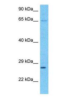 AZI2 / NAP1 Antibody - Western blot of AZI2 Antibody with human 786-0 Whole Cell lysate.  This image was taken for the unconjugated form of this product. Other forms have not been tested.