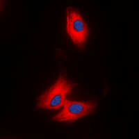 AZI2 / NAP1 Antibody - Immunofluorescent analysis of NAP1 staining in THP1 cells. Formalin-fixed cells were permeabilized with 0.1% Triton X-100 in TBS for 5-10 minutes and blocked with 3% BSA-PBS for 30 minutes at room temperature. Cells were probed with the primary antibody in 3% BSA-PBS and incubated overnight at 4 C in a humidified chamber. Cells were washed with PBST and incubated with a DyLight 594-conjugated secondary antibody (red) in PBS at room temperature in the dark. DAPI was used to stain the cell nuclei (blue).