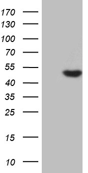 AZIN1 Antibody - HEK293T cells were transfected with the pCMV6-ENTRY control. (Left lane) or pCMV6-ENTRY AZIN1. (Right lane) cDNA for 48 hrs and lysed