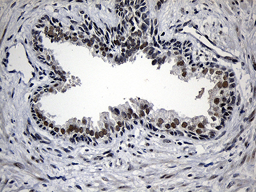 AZIN1 Antibody - Immunohistochemical staining of paraffin-embedded Human prostate tissue within the normal limits using anti-AZIN1 mouse monoclonal antibody. (Heat-induced epitope retrieval by 1mM EDTA in 10mM Tris buffer. (pH8.5) at 120°C for 3 min. (1:2000)