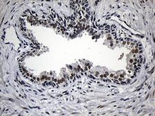 AZIN1 Antibody - Immunohistochemical staining of paraffin-embedded Human prostate tissue within the normal limits using anti-AZIN1 mouse monoclonal antibody. (Heat-induced epitope retrieval by 1mM EDTA in 10mM Tris buffer. (pH8.5) at 120°C for 3 min. (1:2000)